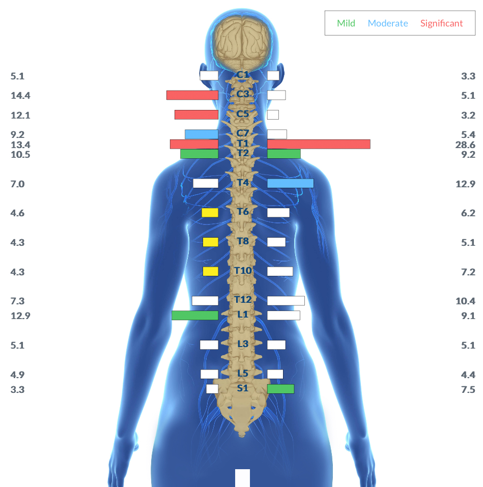 Hypotonia: The Neurological Roots Behind "Floppy Baby Syndrome" | PX Docs