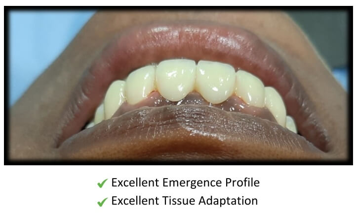 dentcare tissue