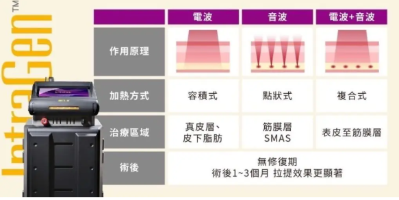 IG電波 vs 傳統電波、音波拉皮