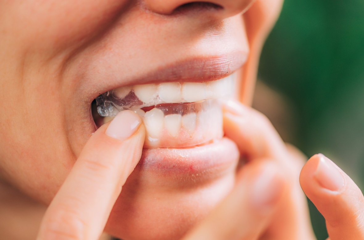 Person applying whitening strips