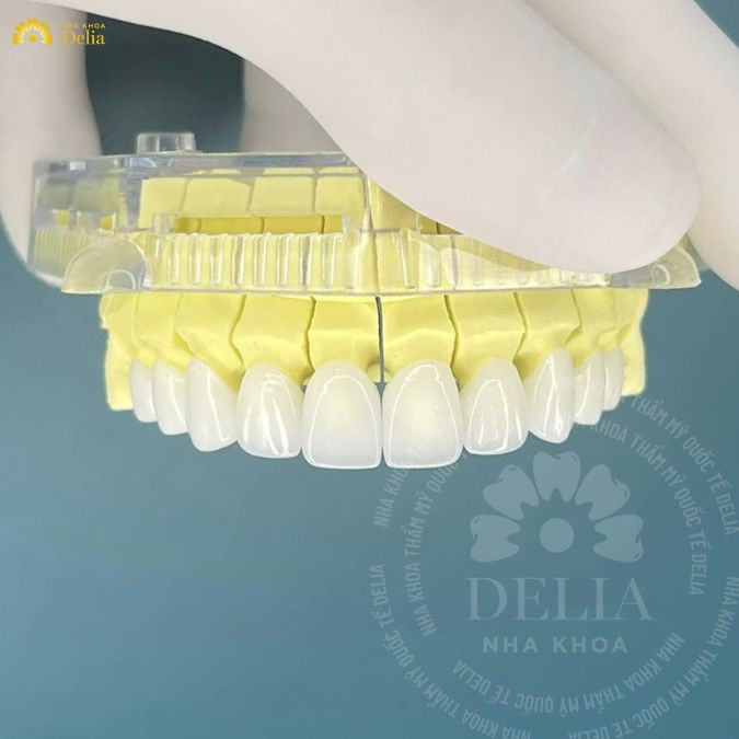 Khách hàng có thể lựa chọn thực hiện theo phương pháp truyền thống, sử dụng sáp để thiết kế mão và cầu răng thủ công