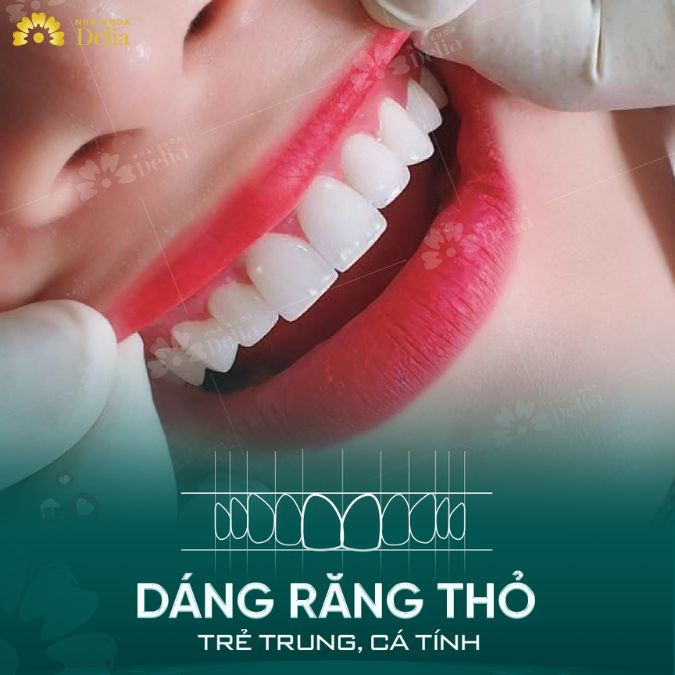 Răng thỏ cũng là một dáng răng mà nhiều người ưa thích