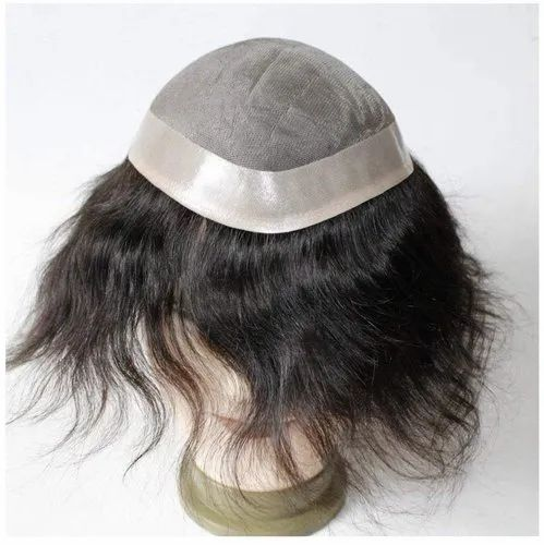 the image show the hair patch by https://renewyou.co.in/