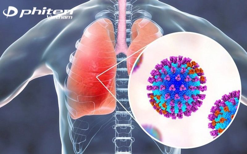 RSV visualized near human lungs