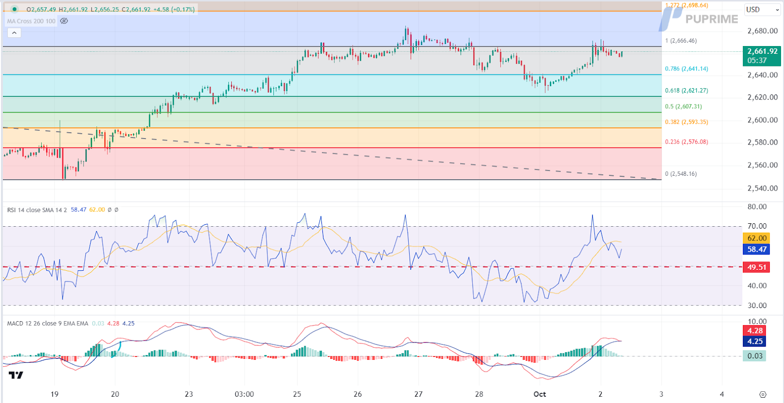 XAUUSD 02102024