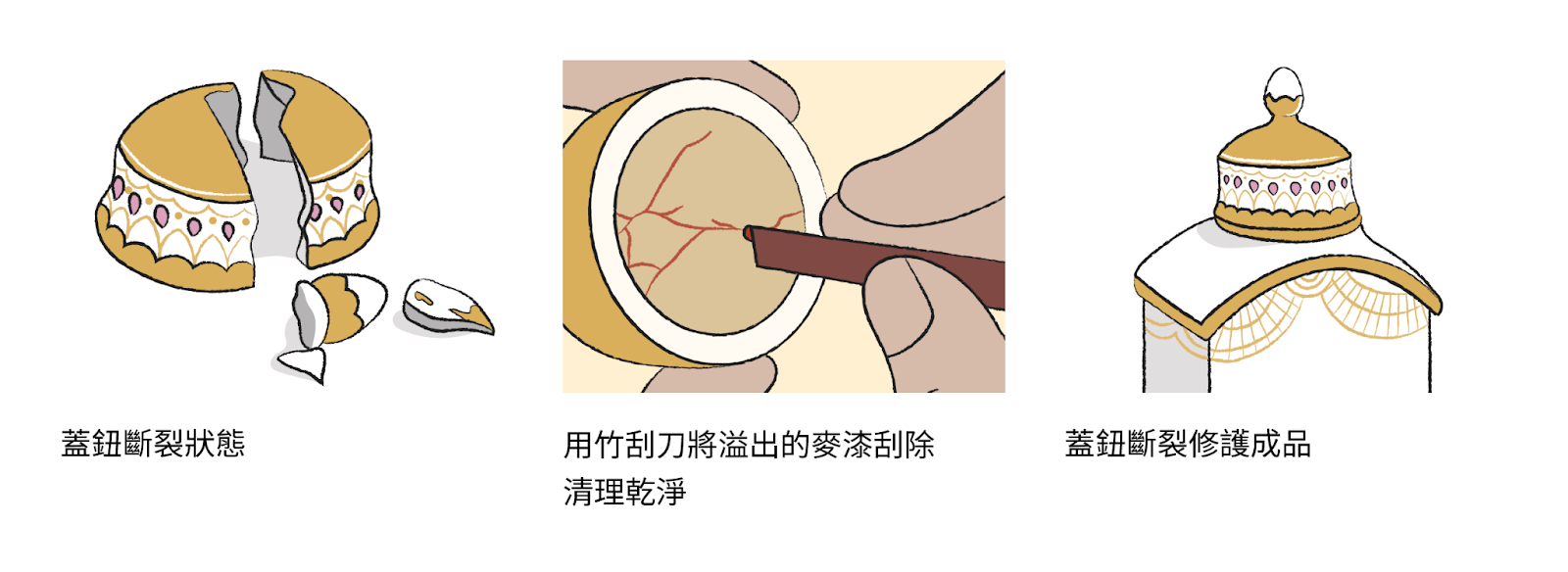 蓋扭斷裂狀態；用竹刮刀將溢出的賣妻刮除清理乾淨；蓋扭斷裂修護成品