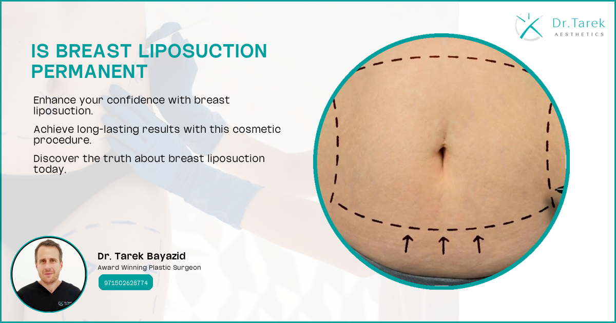 Can Liposuction Be Done On Breasts