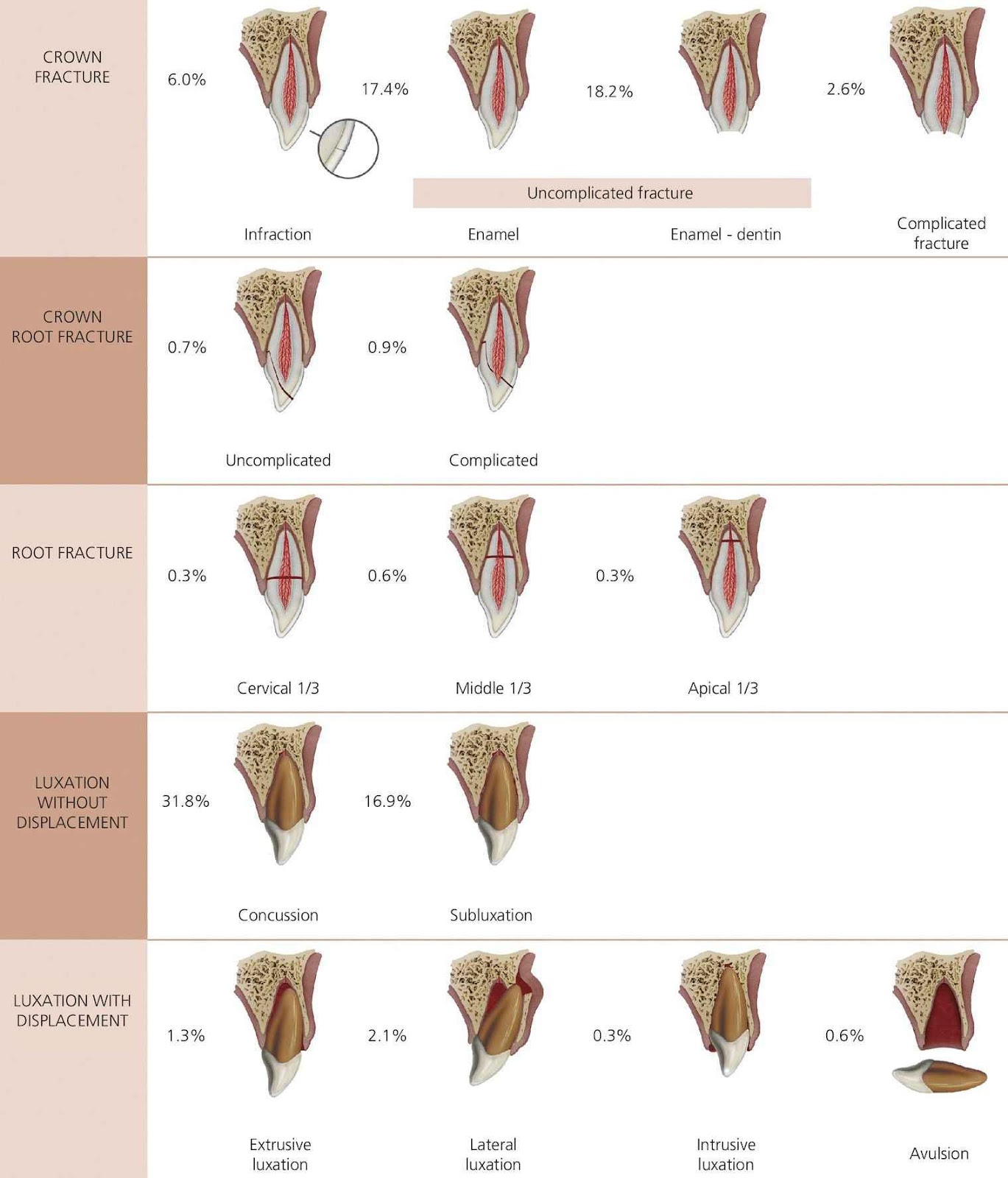 Traumatic Dental Injuries