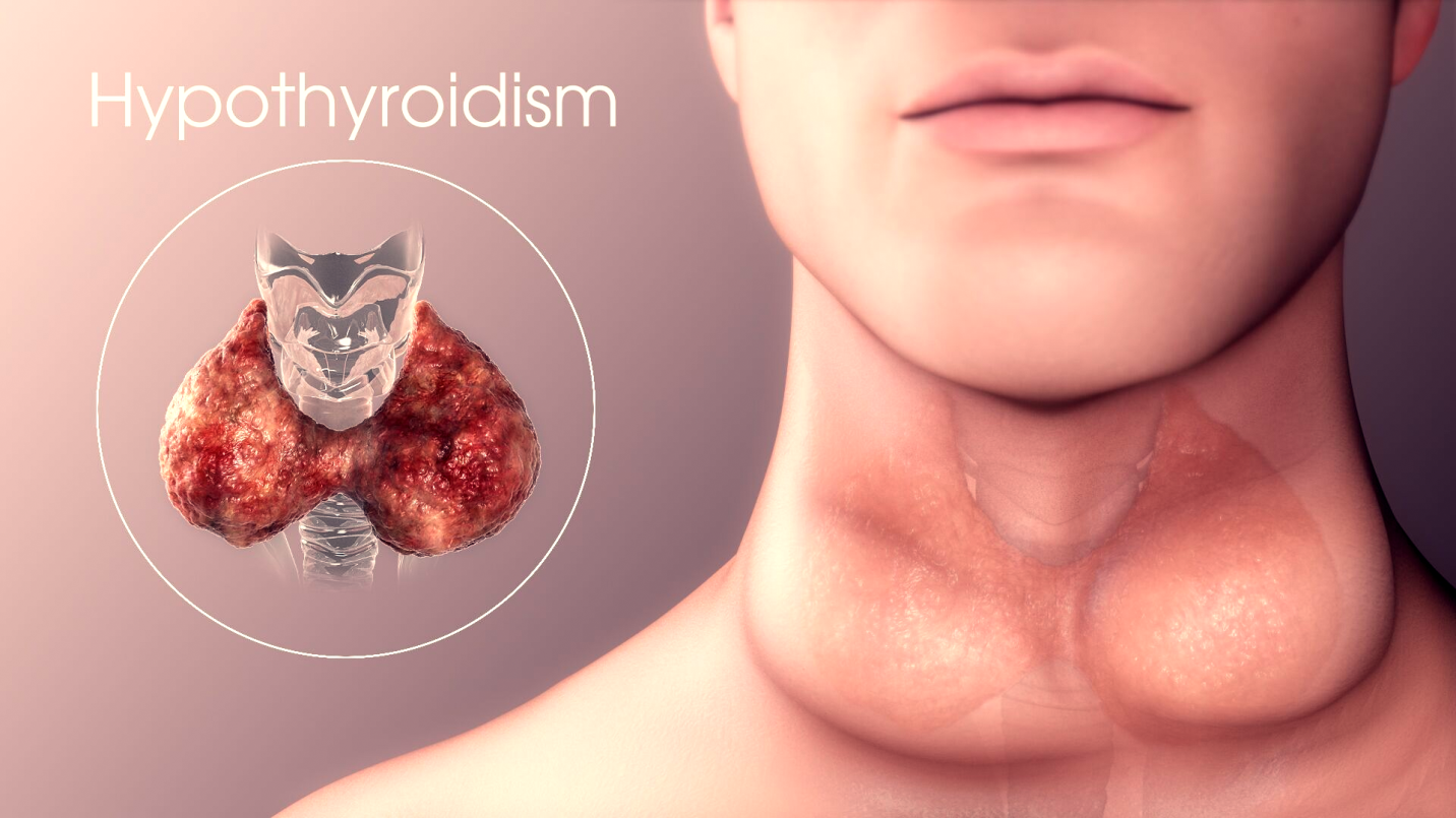 NP Thyroid vs Levothyroxine: Real Comparison to Benefit Your Thyroid