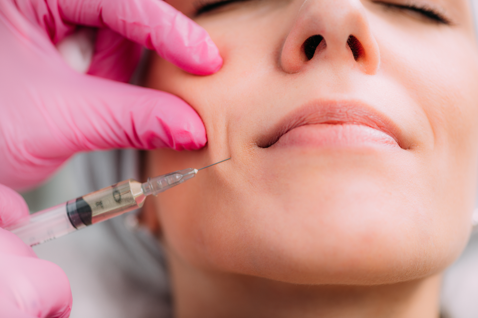 A close-up of a woman receiving a dermal filler injection in the cheek area, administered by a professional wearing pink gloves.