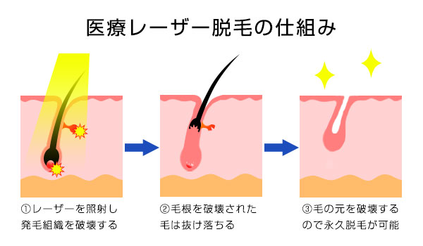 AV女優募集 求人