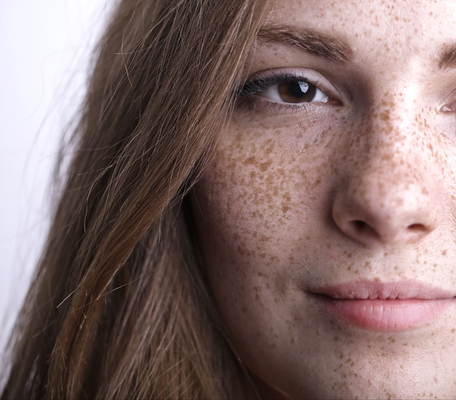 woman freckle skin