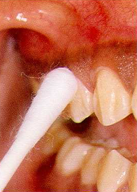 Exámenes biológicos en odontología