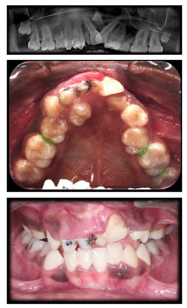 clinical corelation ajisha