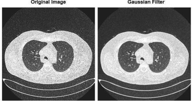 How Gaussian Noise Makes Medical AI Smarter