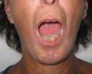 A person with the mouth open

Description automatically generated with medium confidence