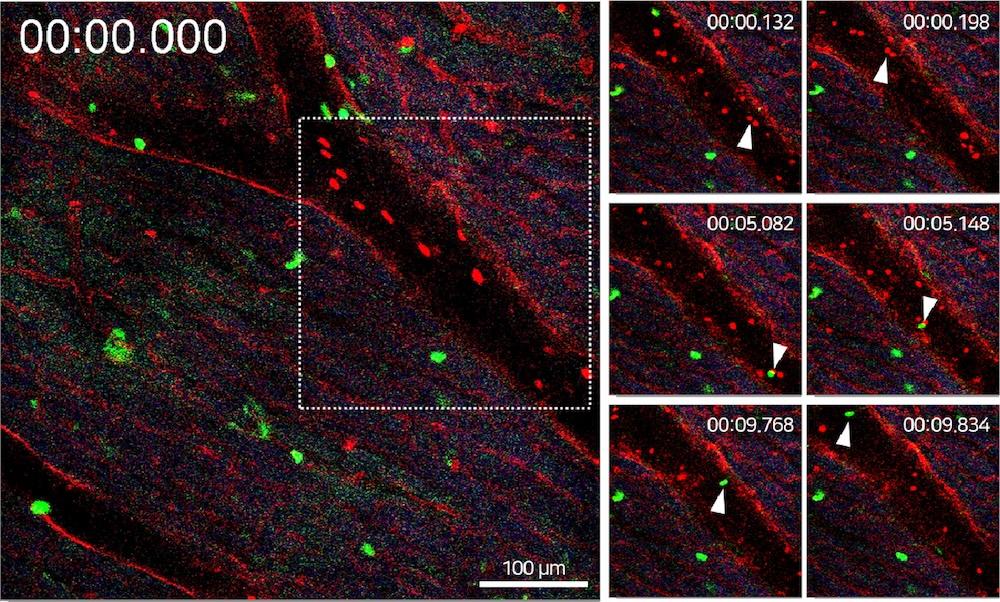 A close-up of several images of a cell

Description automatically generated