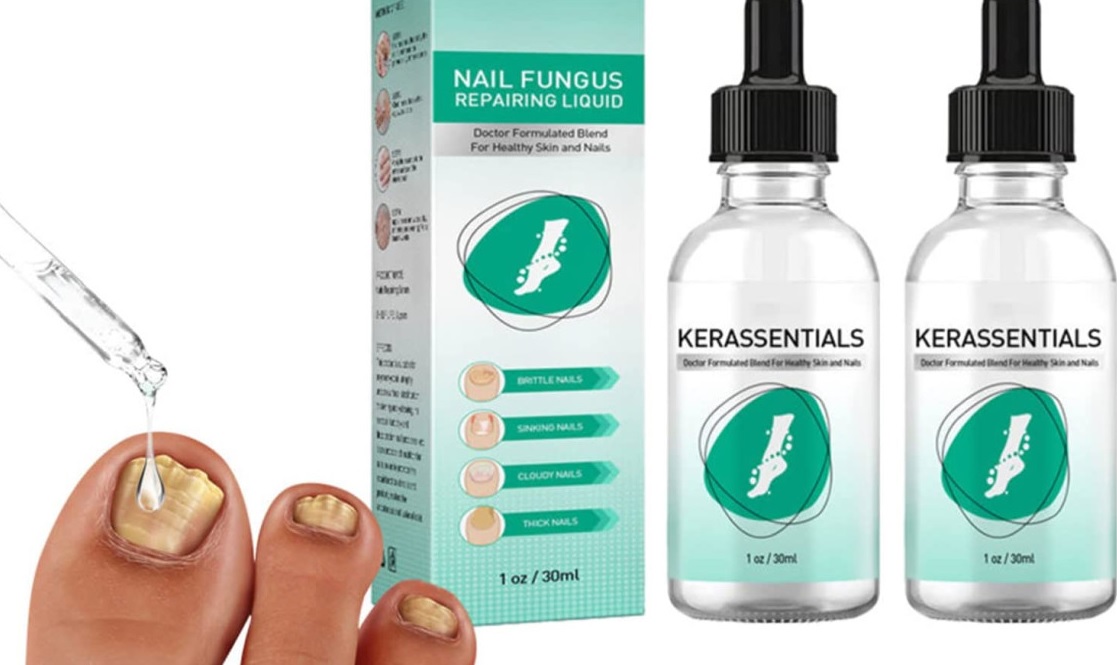 Kerassentials Toenail Fungus Oil REVIEW