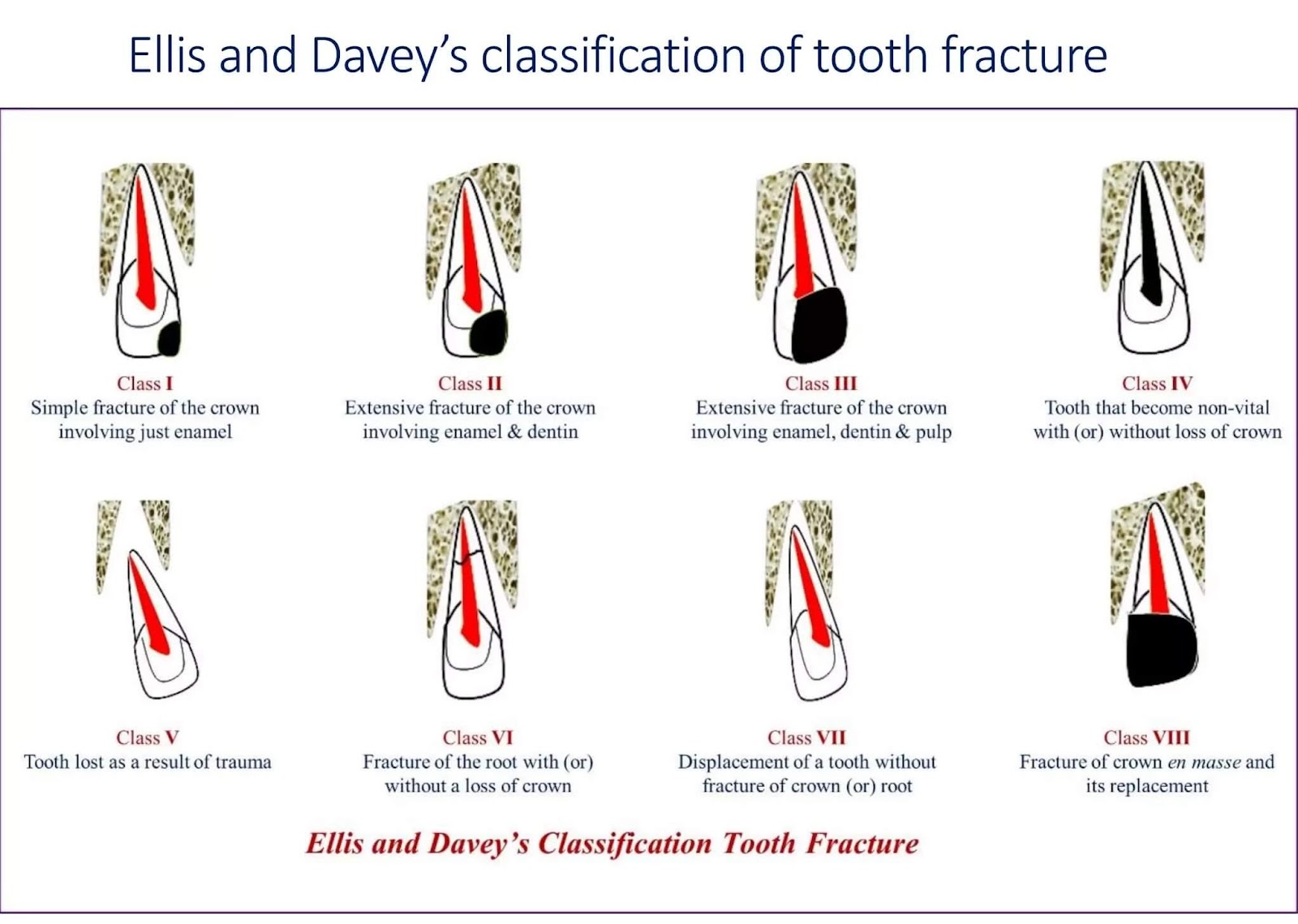 Traumatic Dental Injuries