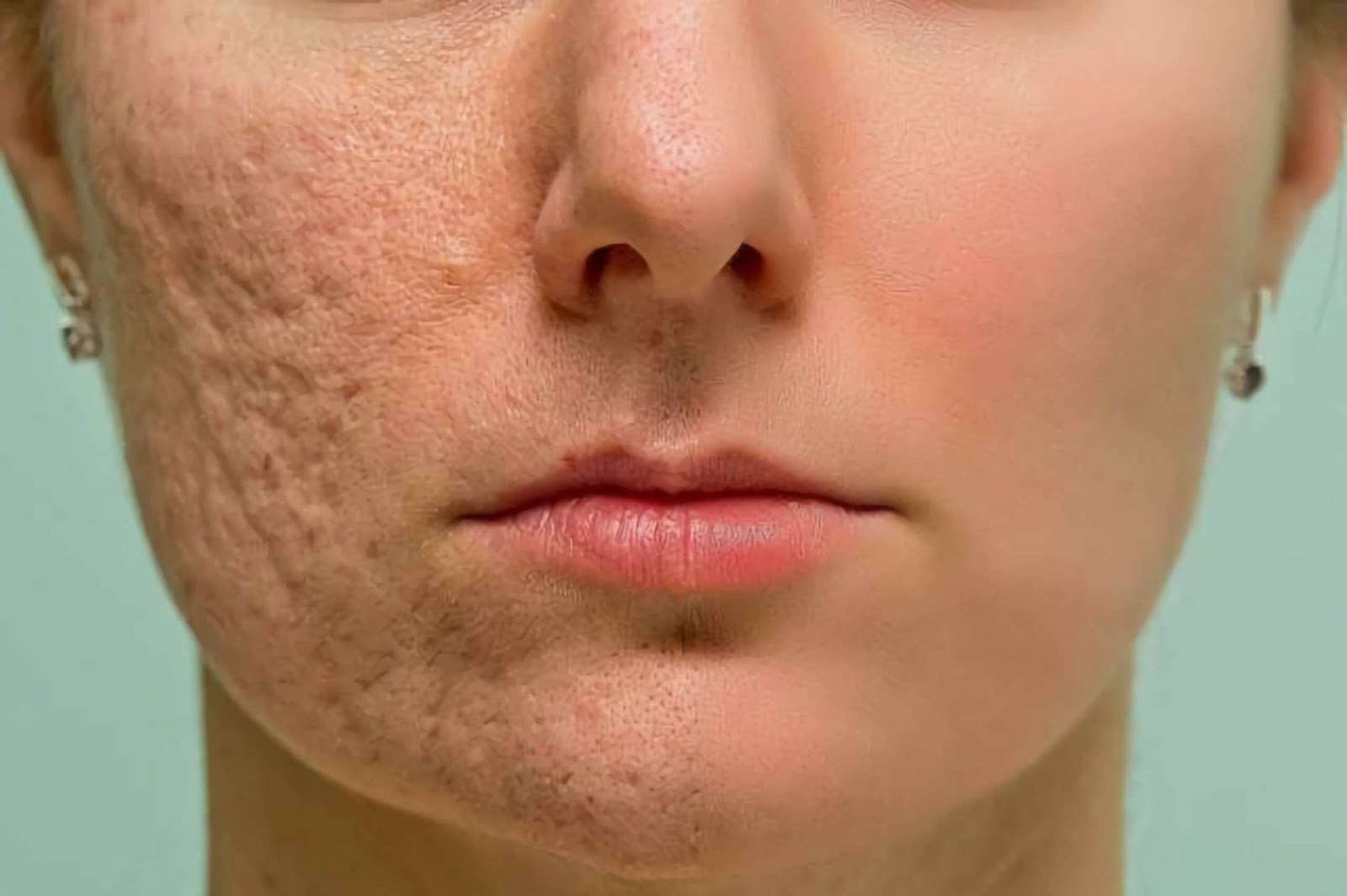 Best Skin Care Routine