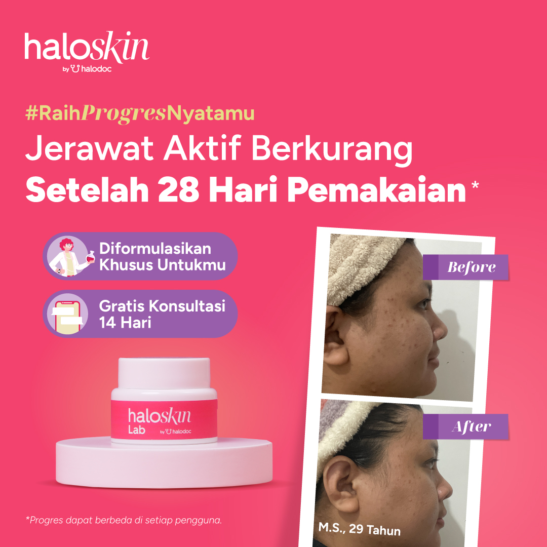 Web_Ads_Haloskin_Testimoni_article