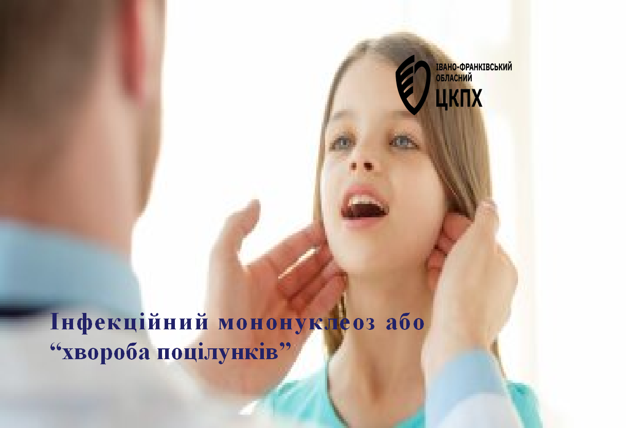Інфекційний мононуклеоз або "хвороба поцілунків"
