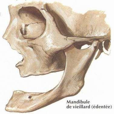 F:\radiologie ahmed\DR _MOUMEN\planches\010-4.JPG