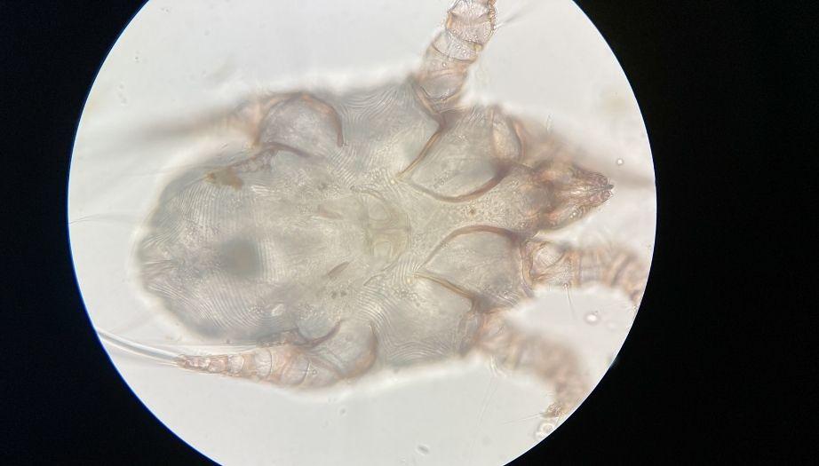 uyuz belirtileri