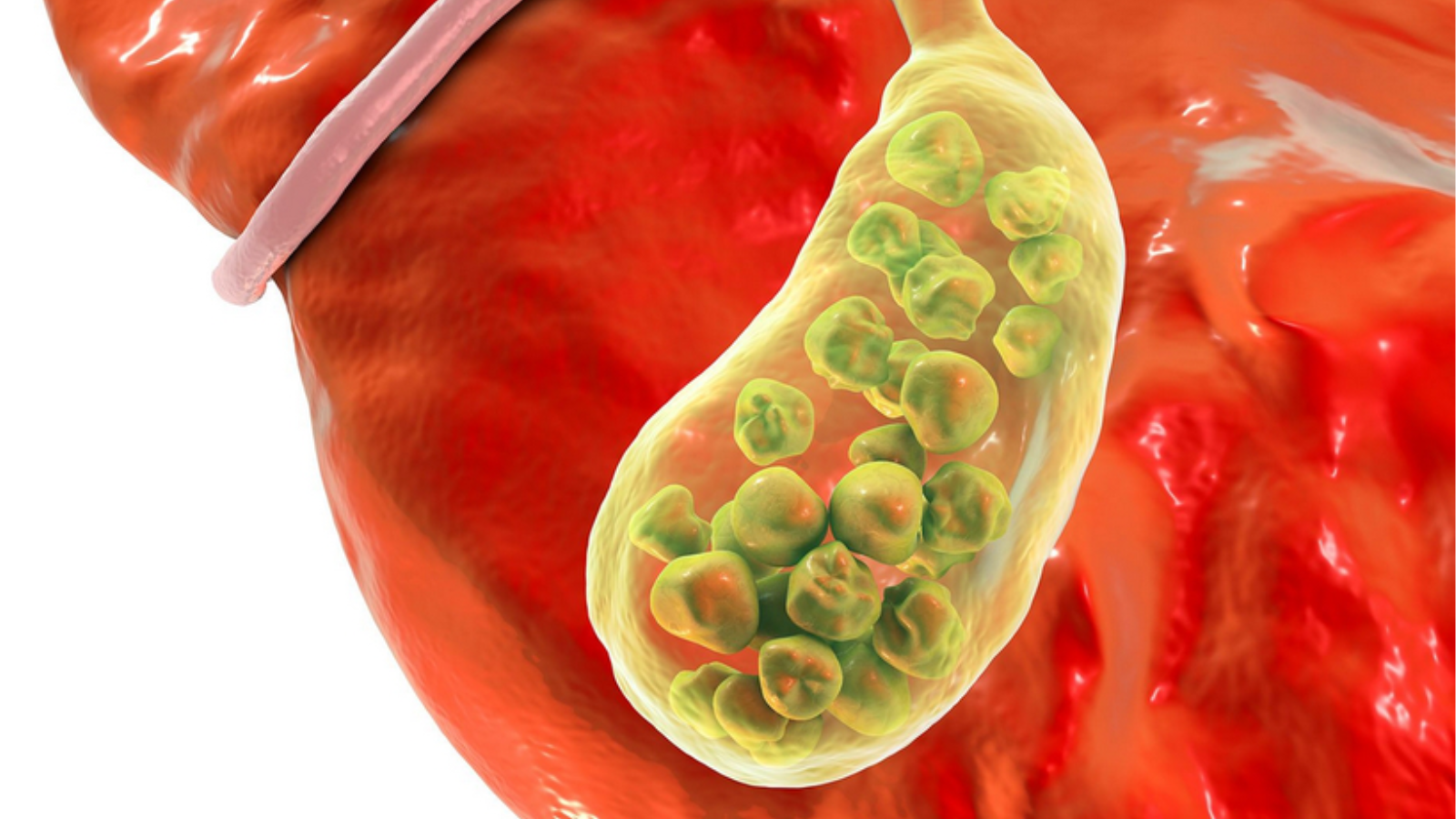 chu-trinh-chuyen-hoa-bilirubin 4