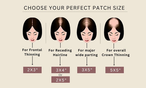 in this image the hair patch sizes are given according to the hairline thinning  by https://renewyou.co.in/