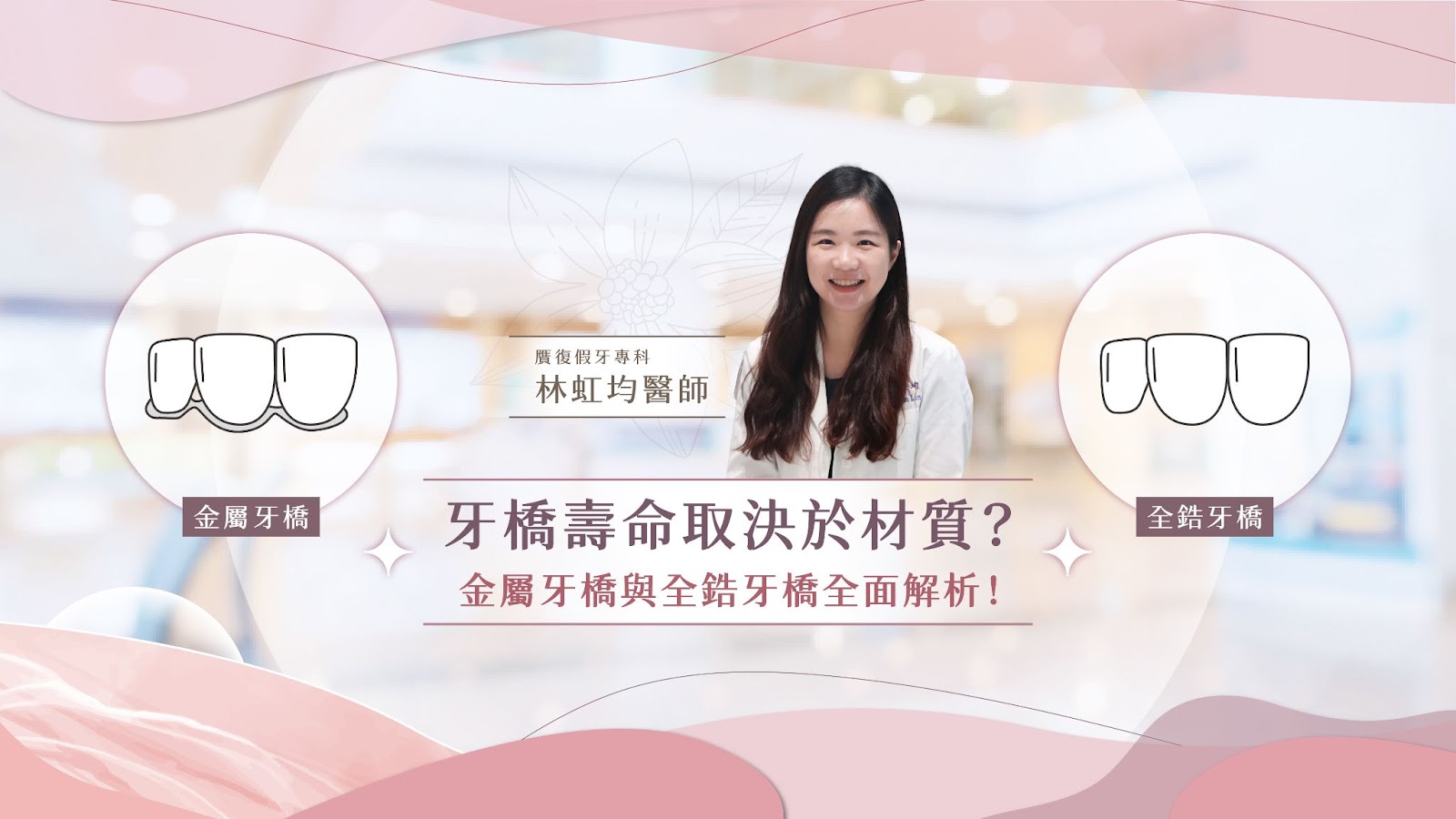 牙橋壽命取決於材質？金屬牙橋與全鋯牙橋全面解析！