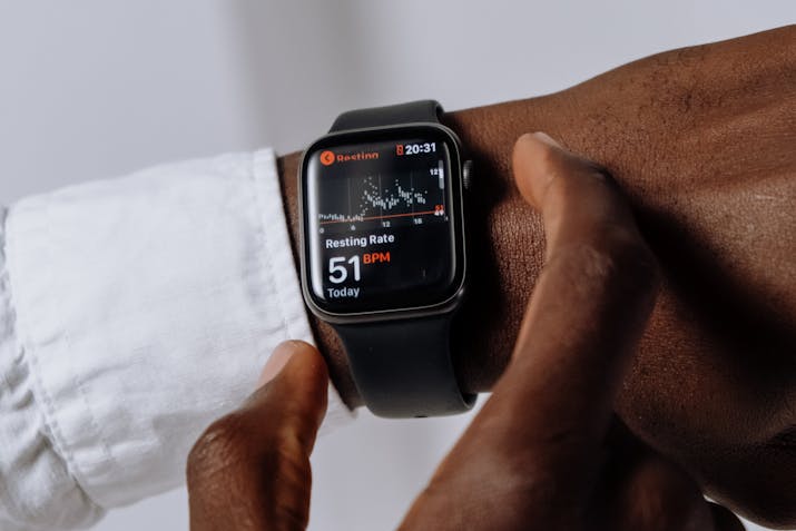 Apple Watch Warranty - Questions Answered 1