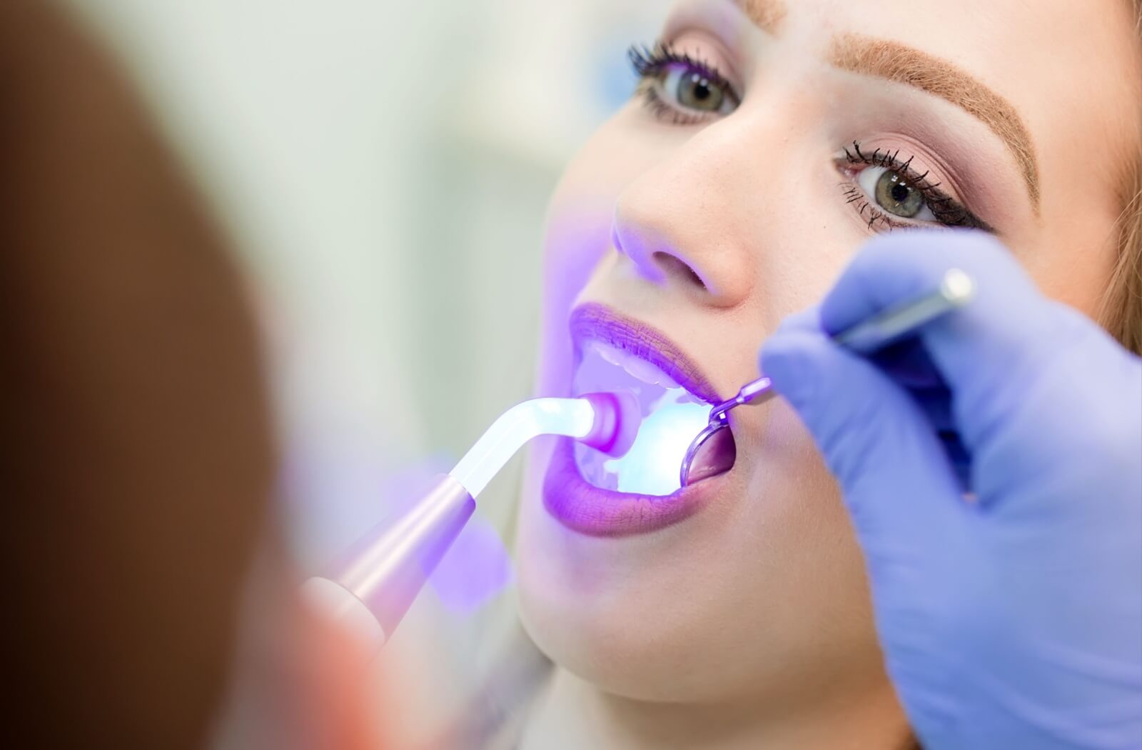 A person has their filling set with a light, a safer approach than amalgam fillings.
