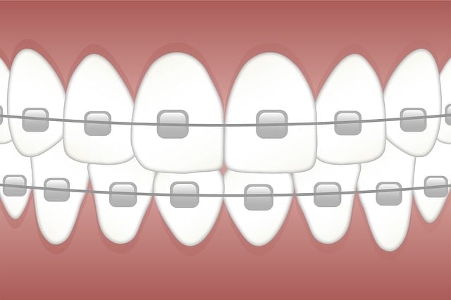 braces, teeth, dentist