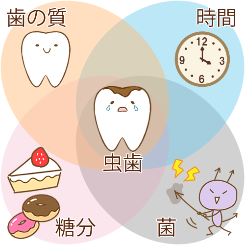 https://www.dental-sozai.com/illust/c/causes_of_caries.png