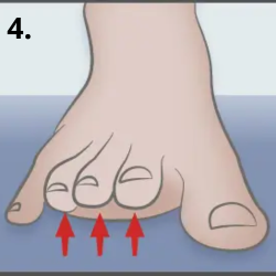 exercices contre aggravation hallux valgus
