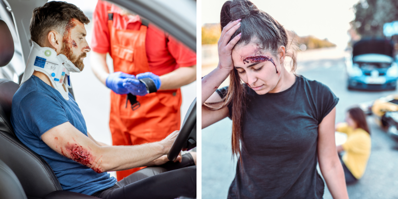 Picture showing serious injuries to the party's involved.