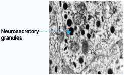 Neurosecretory Granules in electron microscope