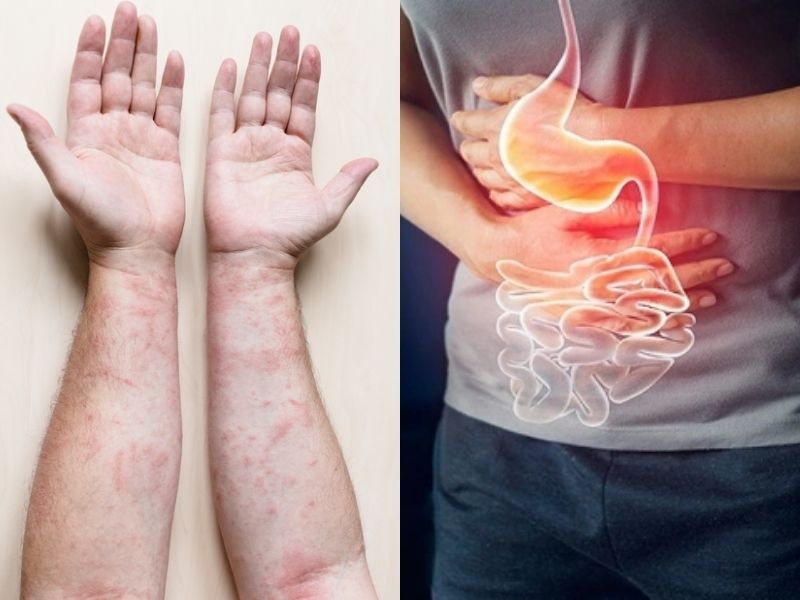 5 Tác hại tiềm ẩn từ việc hôn hoặc để thú cưng liếm lên da 3