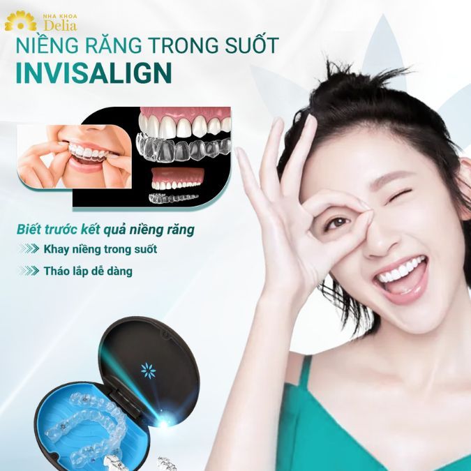 Niềng răng vô hình là phương pháp chỉnh nha theo công nghệ mới