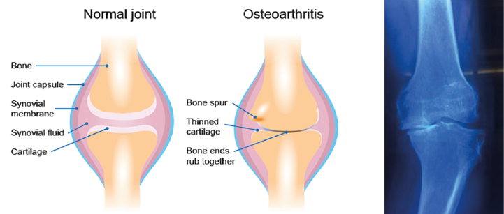 knee-oad303b269ca4e6c2ea63cff00001f8f43