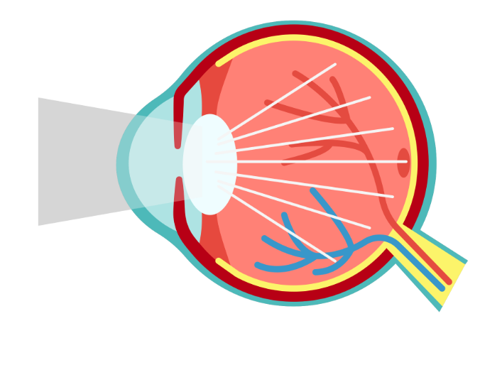 Cataract Surgery in Singapore and When Do You Need It?