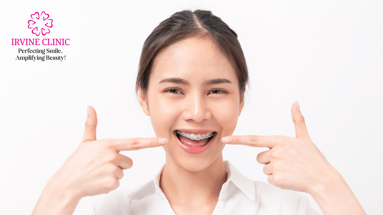 Orthodontic (Braces) Treatment