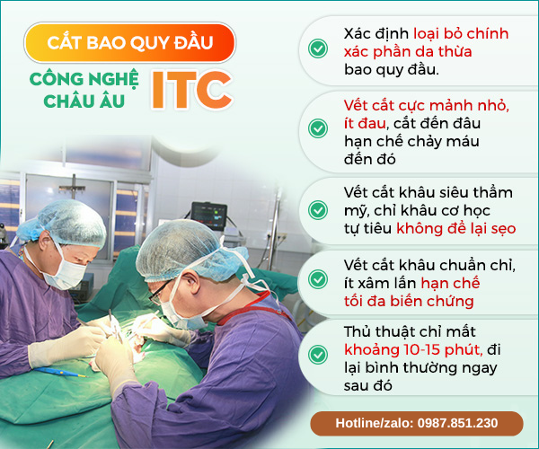 Cắt bao quy đầu theo công nghệ ITC