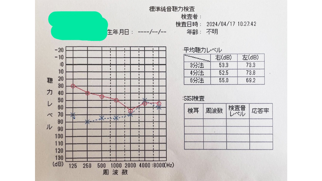 見出し5画像_嶋村吉洋社長が主催するワクセルのコラム_みみトモ。ランド代表_高野恵利那さん_標準純音聴力検査