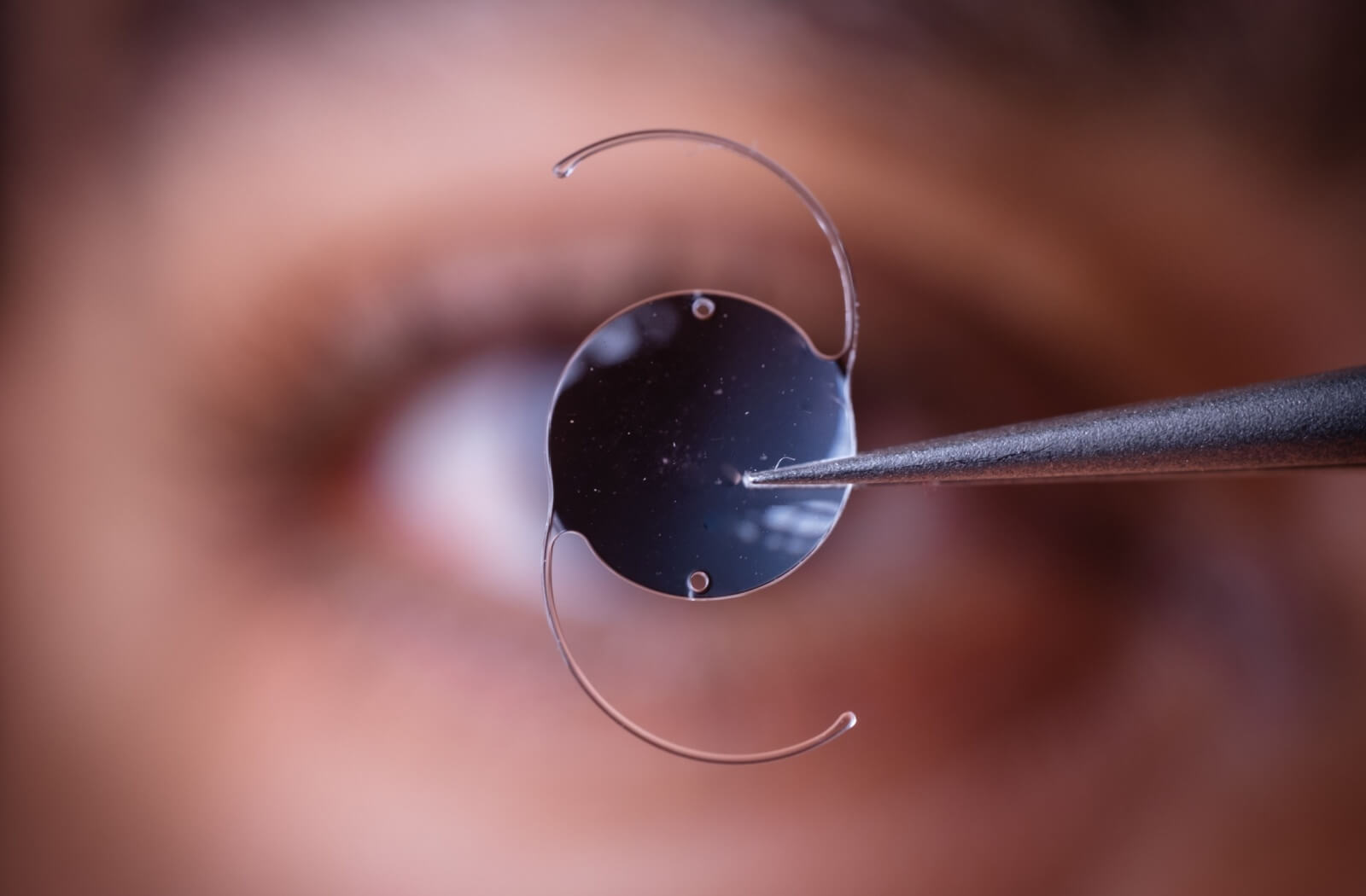 Close-up of an eye surgeon holding an artificial intraocular lens with tweezers.