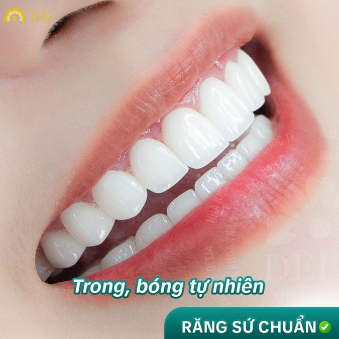 Lớp men sứ bên ngoài được chế tác tỉ mỉ, mang đến màu sắc tự nhiên, trắng sáng