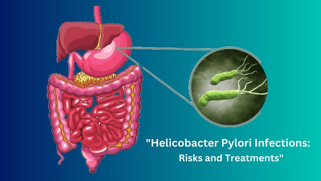 Helicobacter Pylori Infections