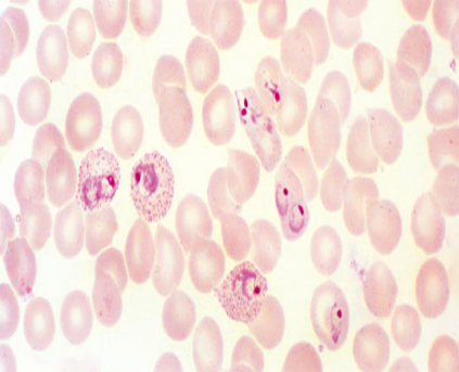 Plasmodium vivax