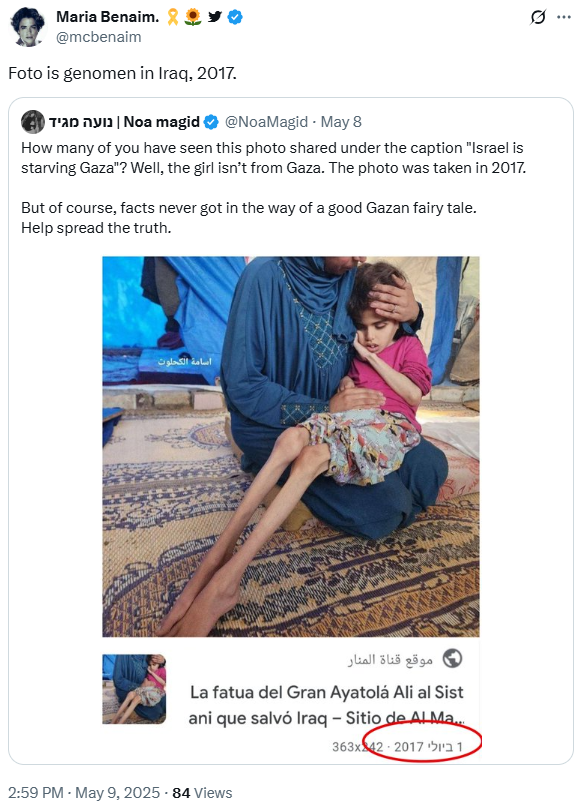 Israeli Trolls Claim Gazans Lied About Malnourished Girl